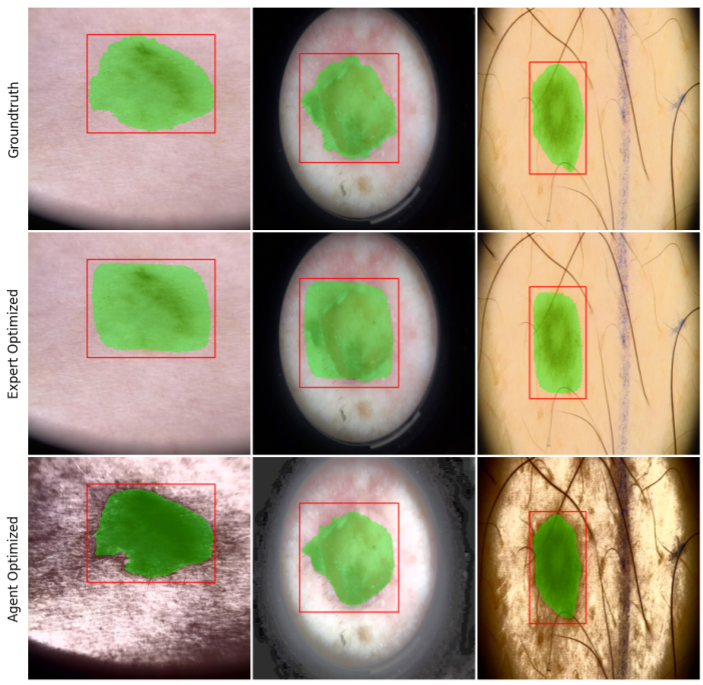 Medical segmentation example