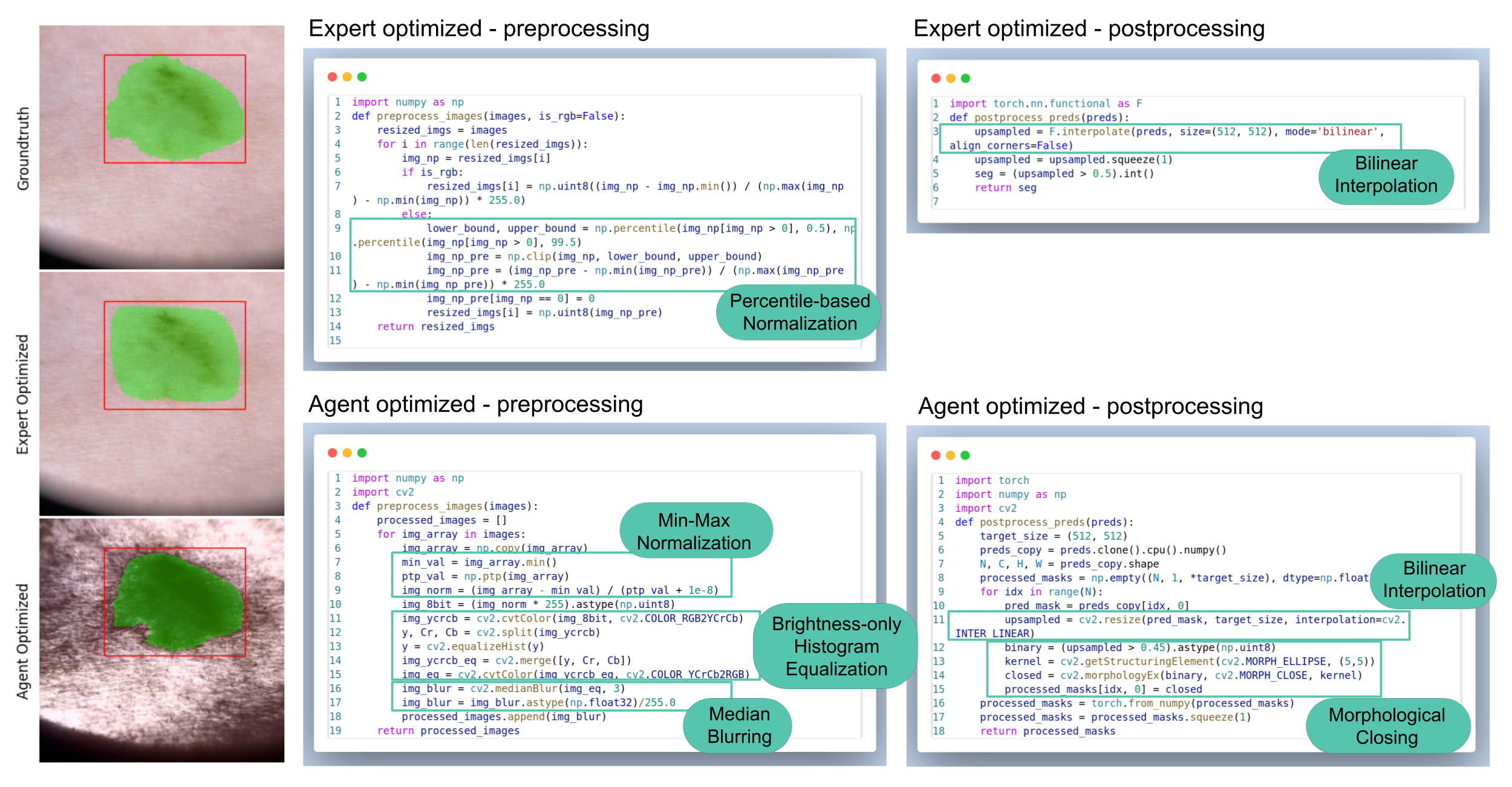 Comparison of expert-optimized and agent-optimized segmentation results
